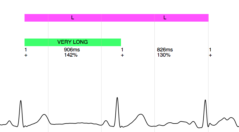 signal with long beats